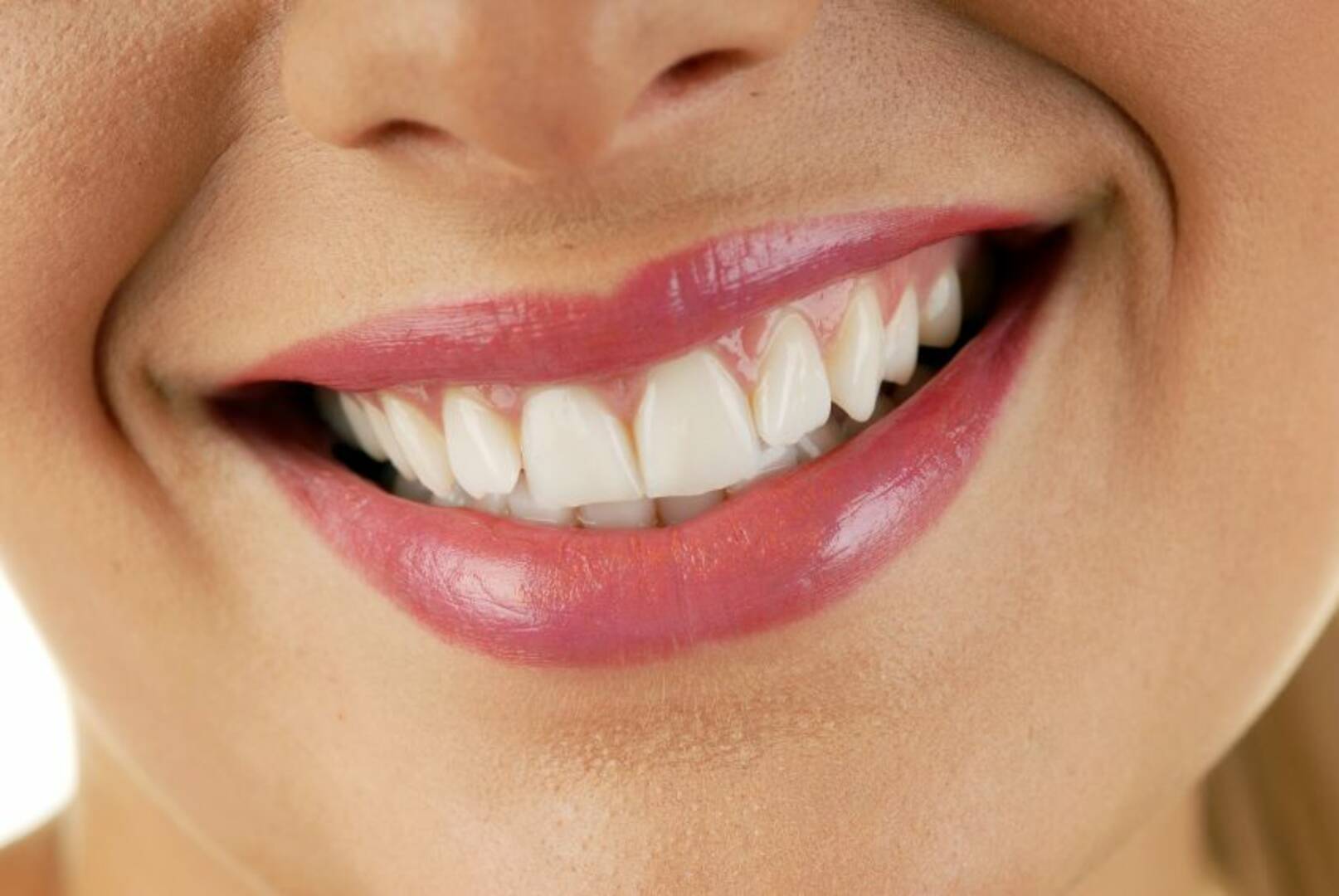 Invisalign For Teens Deerfield IL